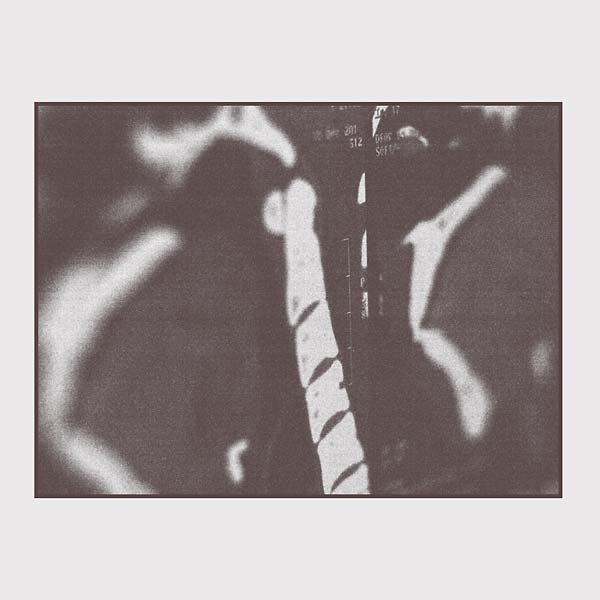 NORMAN WESTBERG MRI